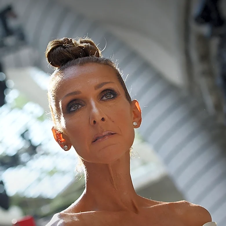 Céline Dion Reveals 17-Year Battle with Stiff Person Syndrome Ahead of Paris Residency