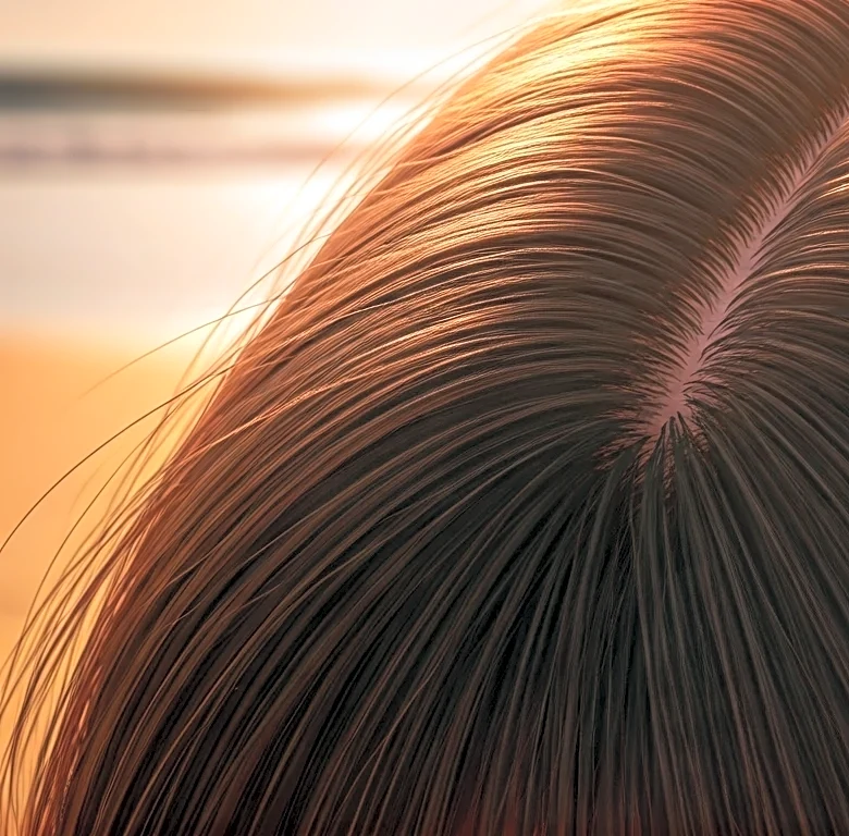 The Hairline Mistake That Leads to Vacation Sunburn