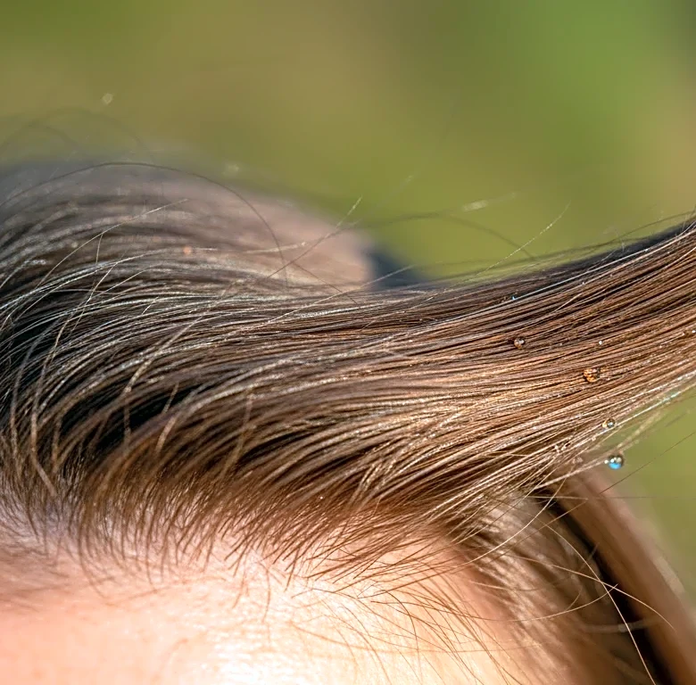 How Viviscal for Hair Growth Quietly Reshaped Modern Hair Care