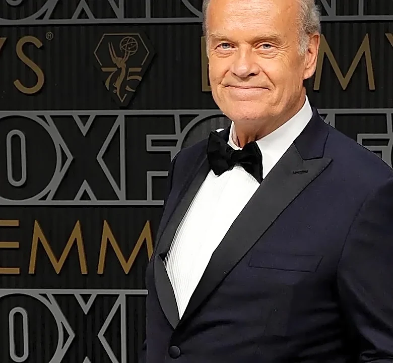 Why Great Prosthetics Can Disappear Into a Performance at the Creative Arts Emmys