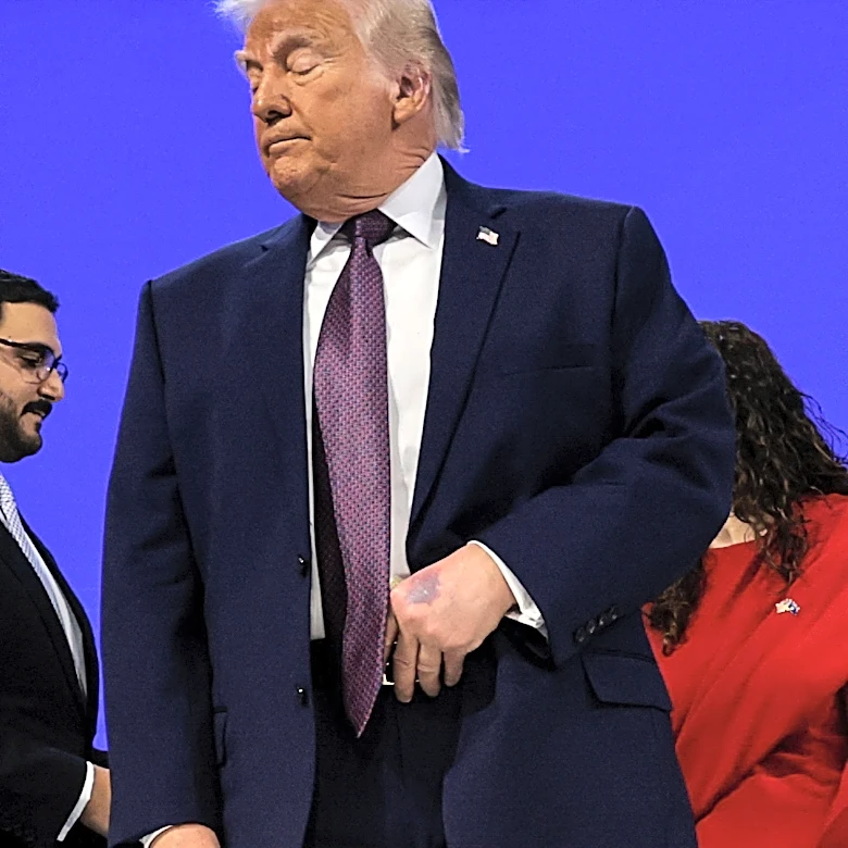 Trump faces health questions ahead of annual Walter Reed physical