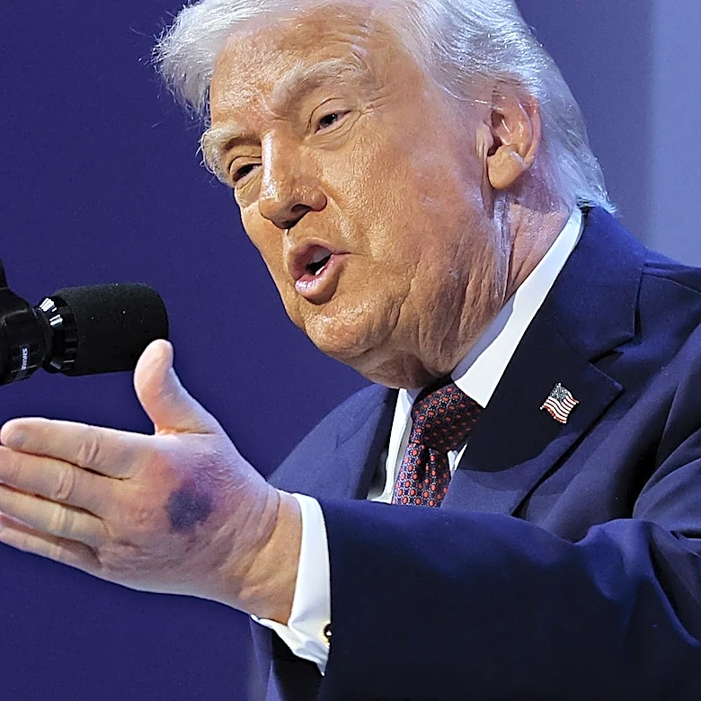 Trump says his semi-annual physical 'checked out PERFECTLY'