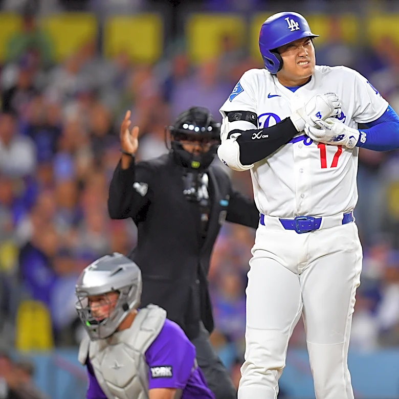 Shohei Ohtani left Tuesday's game with injury. Will he play Wednesday?