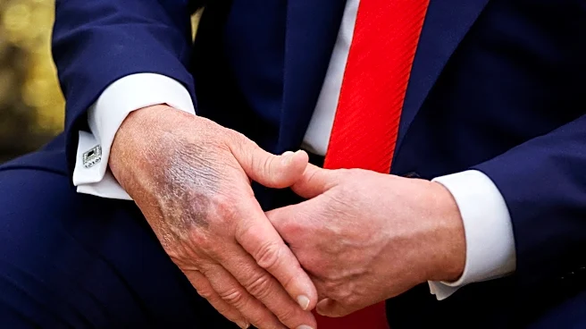 White House releases Trump's physical results, says he's in 'excellent health' but almost obese
