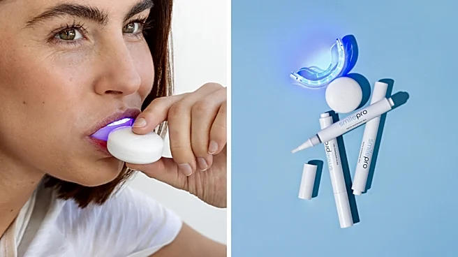 This $148 at-home teeth whitening kit is under $75 for summer