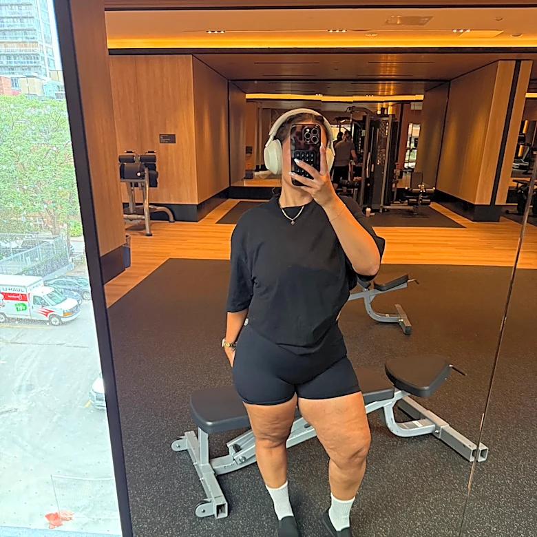 She thought her legs 'looked funny.' It was actually this condition