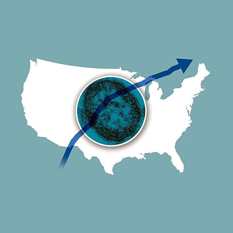 Case map and graphs capture resurgence of disease once eliminated in the US