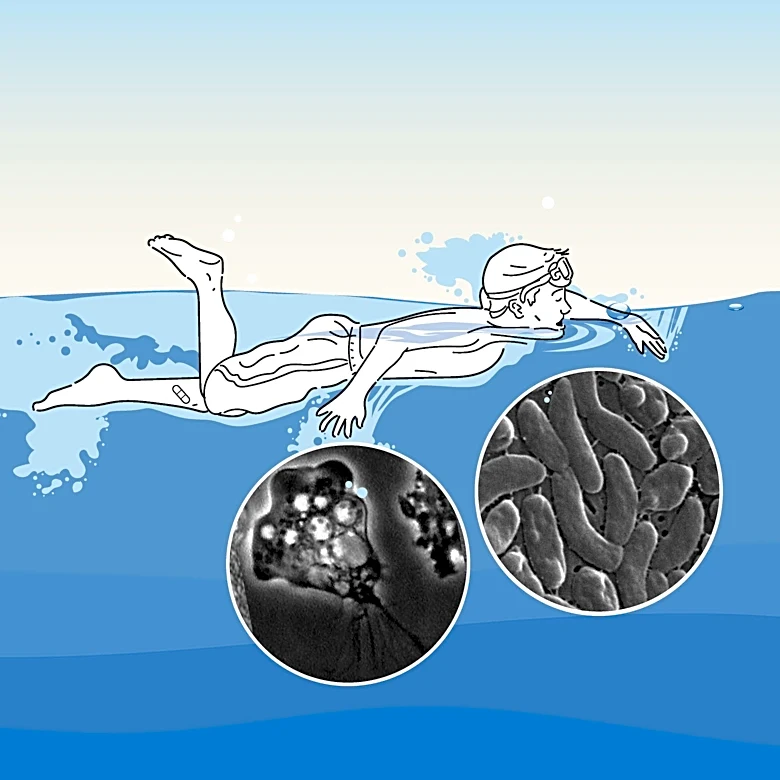 Recent deaths spotlight flesh-eating bacteria and brain-eating amoebas
