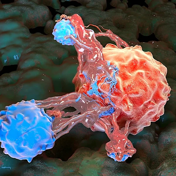 FDA approves life-extending pancreatic cancer drug Rasonque