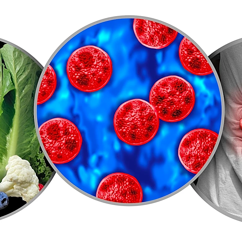 Confirmed cyclospora cases surpass 17,000. See map of affected states