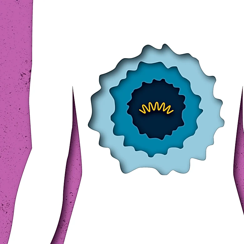 Personalized mRNA cancer vaccines offer new hope. We explain