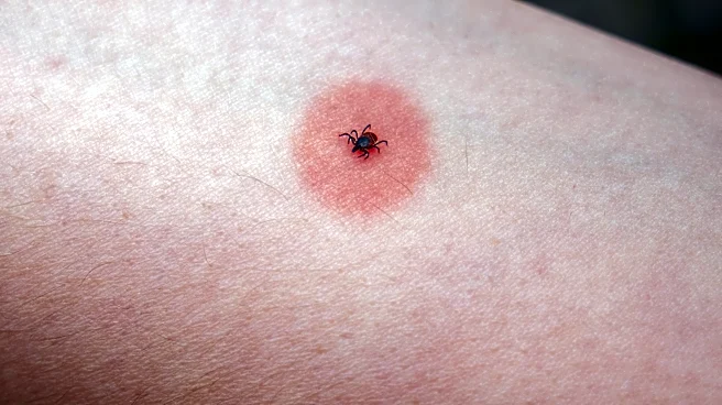 The early signs of Lyme disease you shouldn't ignore