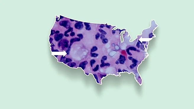 Brain-eating amoeba map shows which states have the most cases