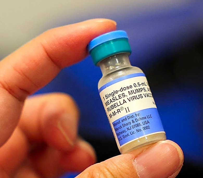 Are measles in Philadelphia? PPHD warns of 2 possible exposures