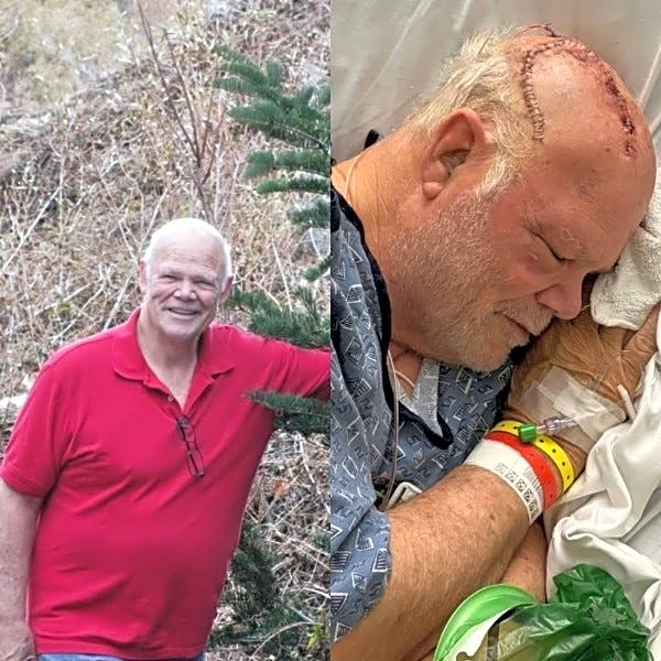 Six Flags sued over X2 coaster. What to know amid brain injury claims