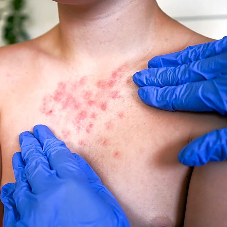 A highly infectious disease is spreading. See in which US states