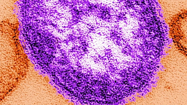Pennsylvania reports sixth death of year in disease outbreak