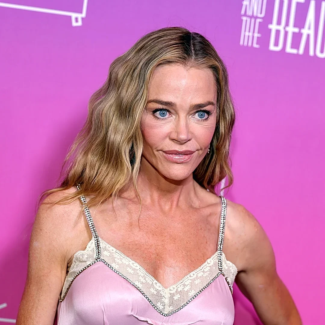 Denise Richards reveals how ex-husband inspired facelift reveal