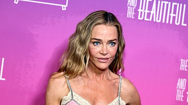 Denise Richards reveals how ex-husband inspired facelift reveal