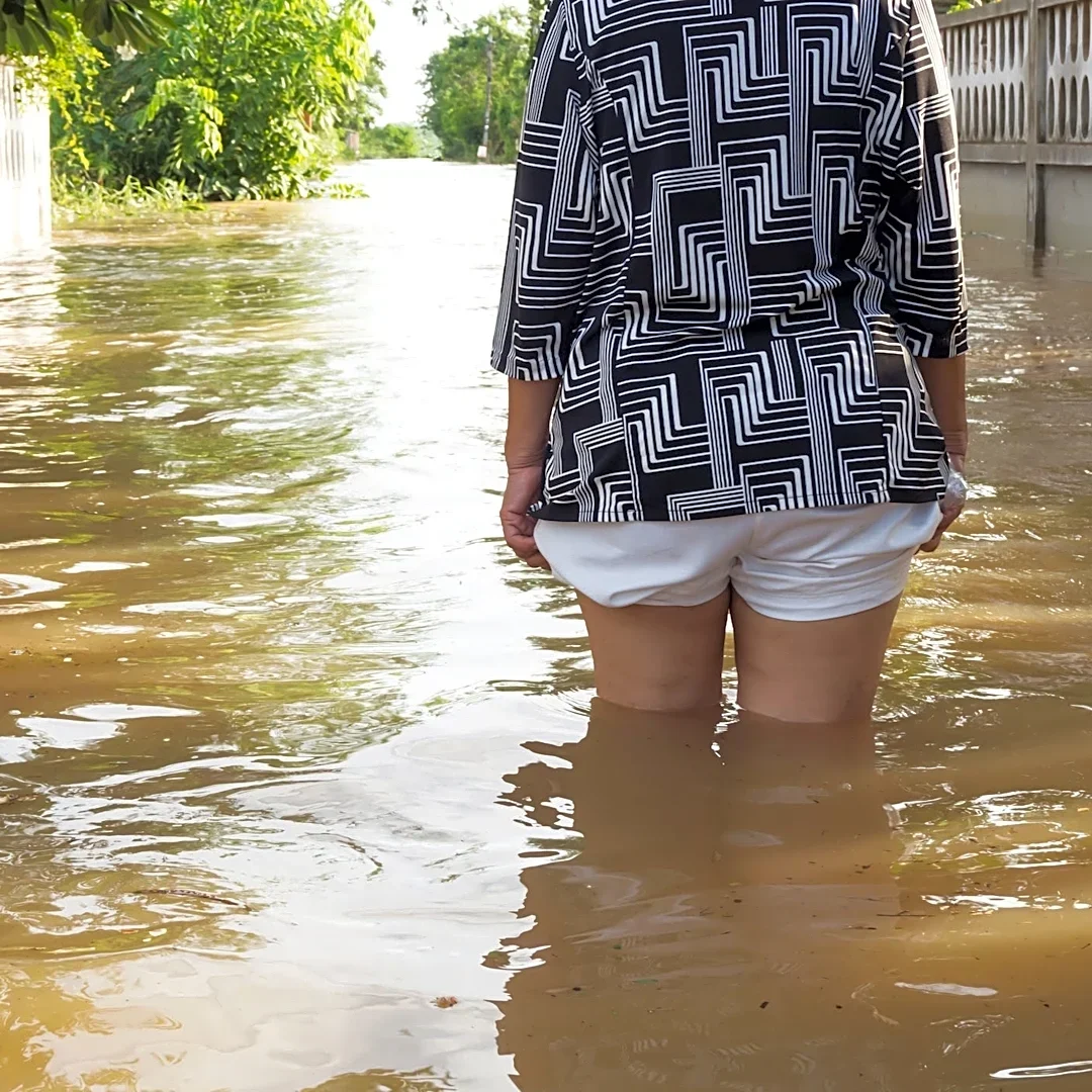 Deadly 'flesh-eating' bacteria can surge after hurricanes. Here's why