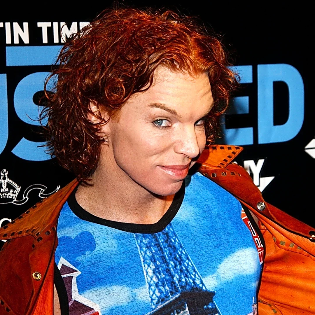Carrot Top breaks silence after suicide attempt – 'I'm truly overwhelmed'