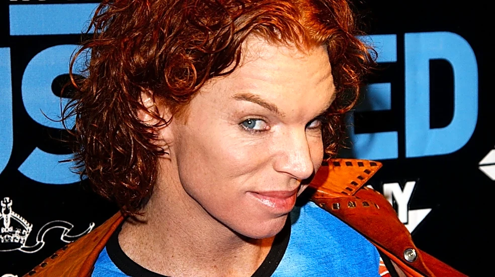 Carrot Top breaks silence after suicide attempt – 'I'm truly overwhelmed'