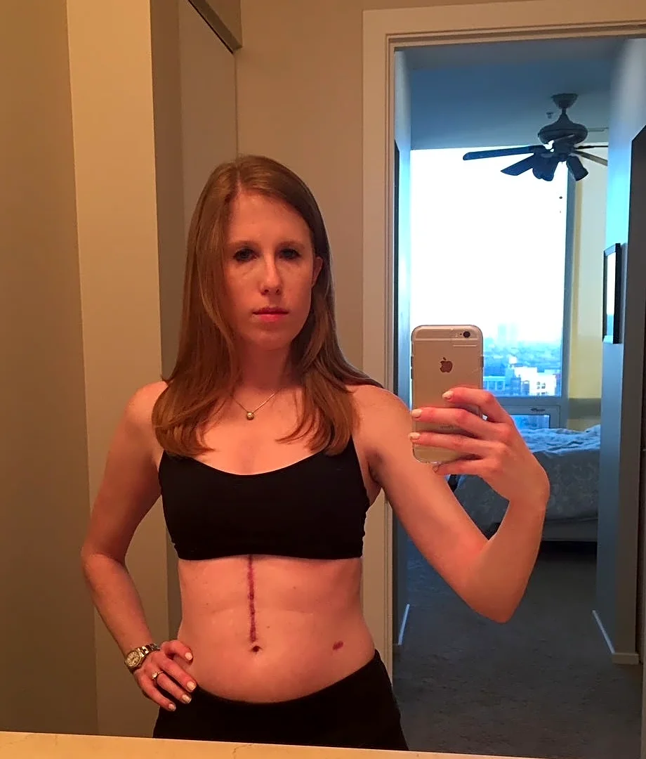 She went to the ER for food poisoning. She was given 6 months to live