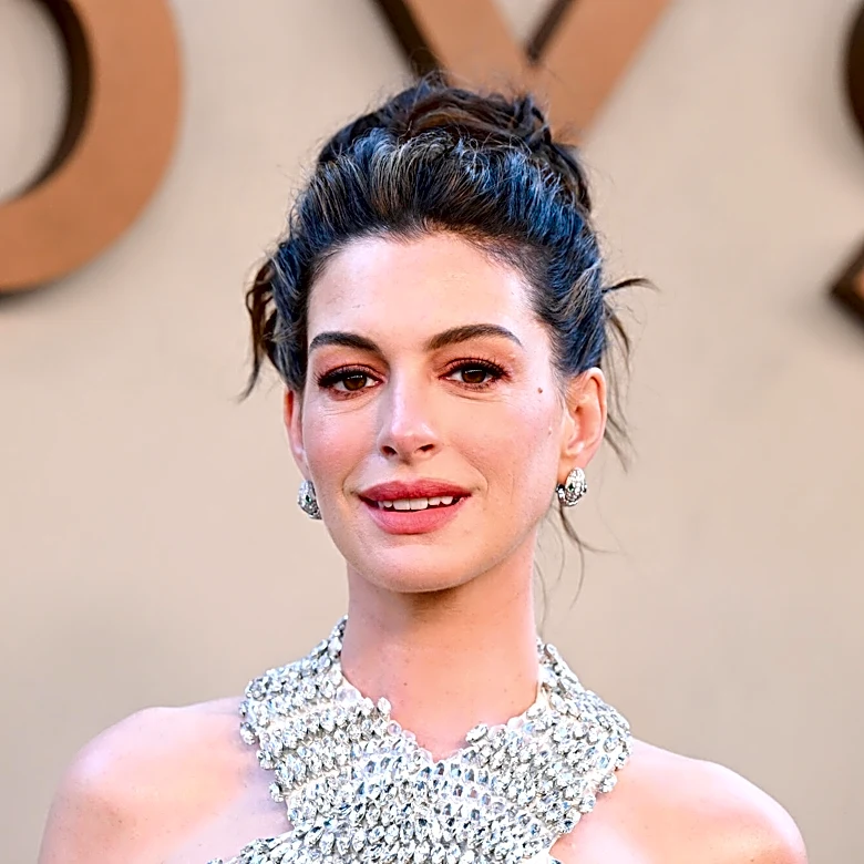 Anne Hathaway Says ‘Movies That Kill Dogs Should Automatically Be Rated R’
