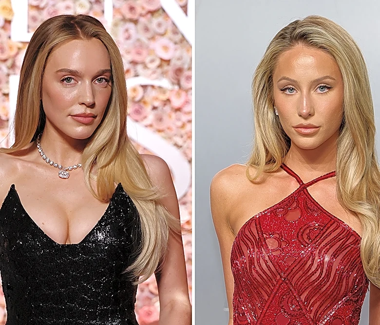 Alix Earle Rips Into ‘Toxic’ Alex Cooper in Fiery Statement on Feud: ‘The Way You Approach Business Is Disgusting. You Choose Money Over Morals’