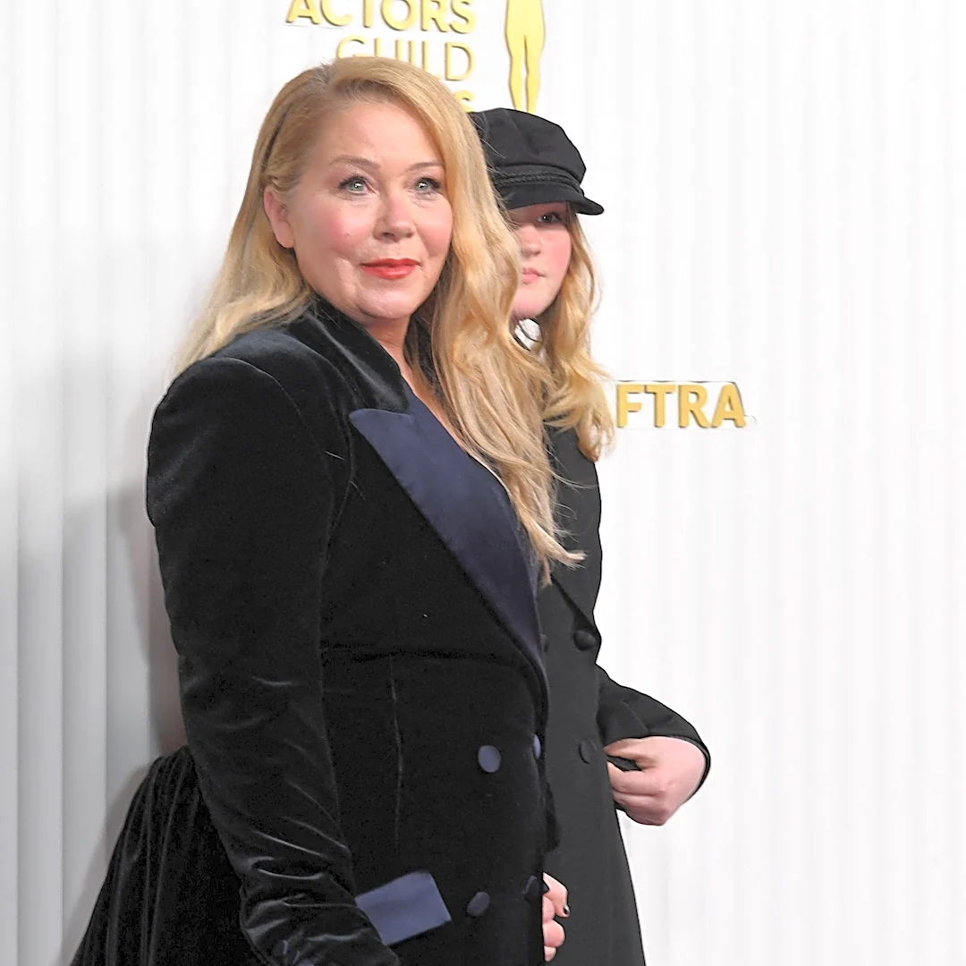 What Christina Applegate’s misdiagnosis reveals about MS
