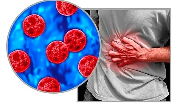 New York cyclosporiasis cases rise again: See the latest update