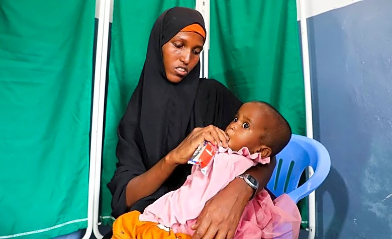 La guerra en Irán supone un nuevo golpe para los niños desnutridos de Somalia
