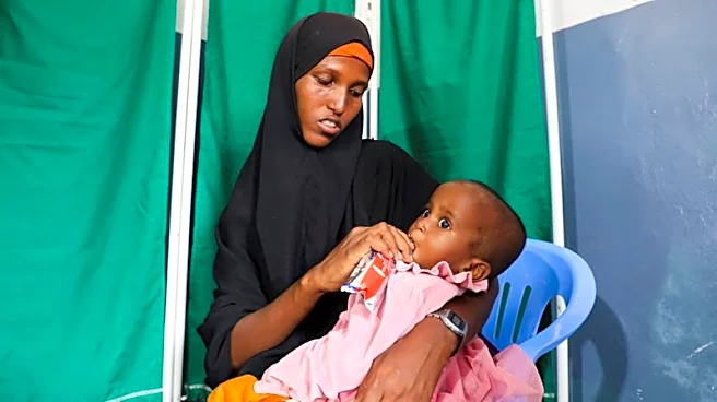 La guerra en Irán supone un nuevo golpe para los niños desnutridos de Somalia